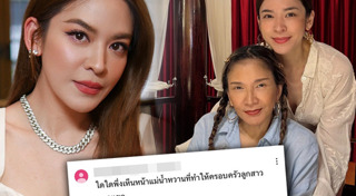 กวาง AB normal