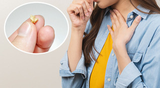 กลิ่นปาก