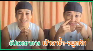 เอ็กซ์ ธิตินันท์