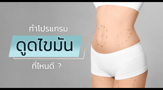 ดูดไขมัน