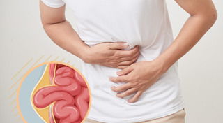 ไส้เลื่อน