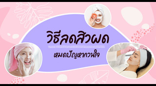 วิธีรักษาสิว