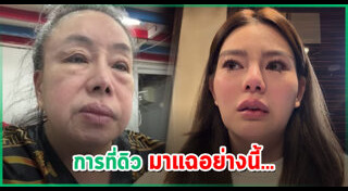 ดาราถูกทำร้ายร่างกาย