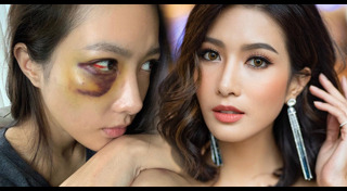 ไอซ์ อธิชนัน