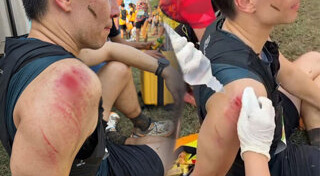 แมทธิว ดีน