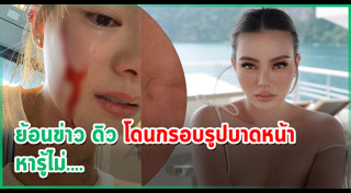 เบนซ์ เดม่อน