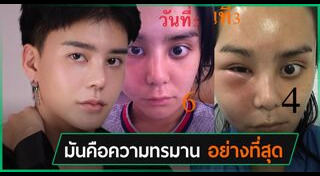 อาร์ม ตรีทิพย์นิภา