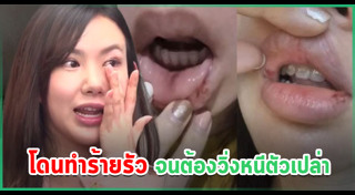 บอส อัศม์กรณ์