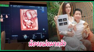 ภัทร จึงกานต์กุล