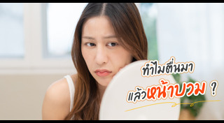 อาการบวมน้ำ