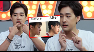 เสริมคาง