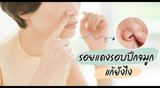 วิธีดูแลผิว