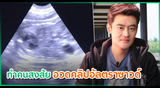 อัลตราซาวด์