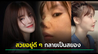 ศัลยกรรมหน้าพัง