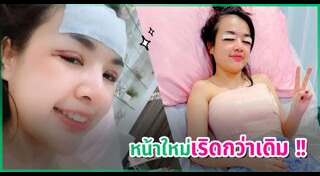 นักร้องศัลยกรรม