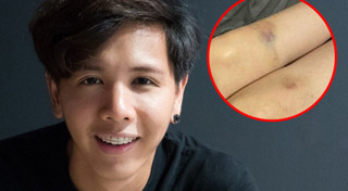 นัท โซลติส