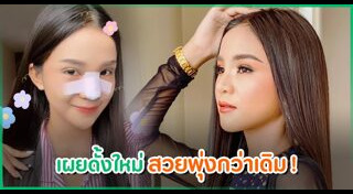 นักร้องศัลยกรรม