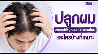 ยาสระผมแก้ผมร่วง