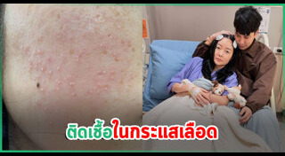 ติดเชื้อในกระแสเลือด