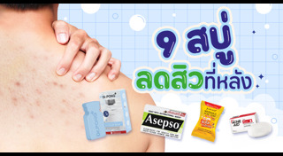 วิธีรักษาสิว