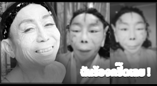 ศัลยกรรมซิกแพก