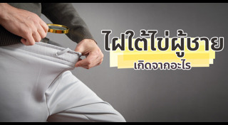 สุขภาพผู้ชาย