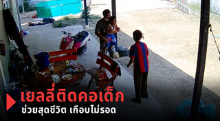 สำลักอาหาร