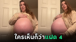ลูกแฝด