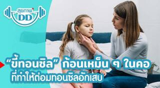 นิ่วทอนซิล