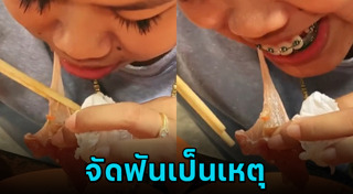 จัดฟัน