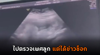 อัลตราซาวด์