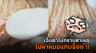 เห็บหมัด