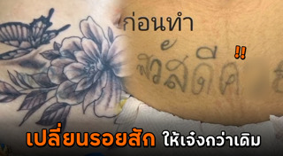 ลบรอยสัก