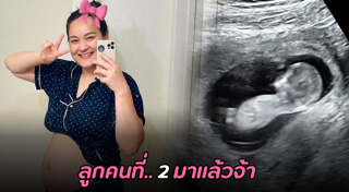 นาตาลี เดวิส