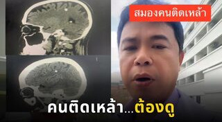 เลิกเหล้า