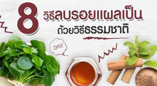 รอยแผลเป็น