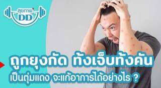 วิธีป้องกันยุงกัด