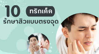 วิธีรักษาสิว