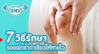 การปฐมพยาบาล