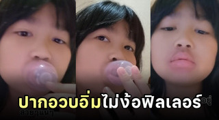 ฉีดฟิลเลอร์