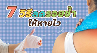 การปฐมพยาบาล