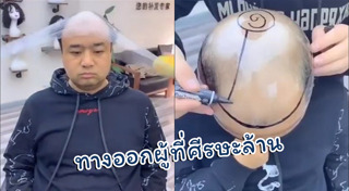 หัวล้าน