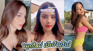 ศัลยกรรมจมูก