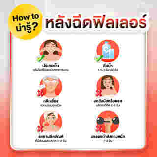 ฟิลเลอร์ ช่วยเรื่องอะไรบ้าง เหมาะกับใคร ฉีดบริเวณไหนได้บ้าง ?