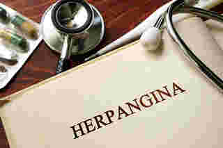 herpangina