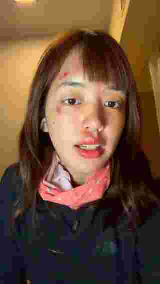 Pigcaploy พลอย Pigkaploy โชว์แผลช้ำเต็มหน้า หลังเที่ยวแอนตาร์กติกา สาเหตุทำคนแห่ ...