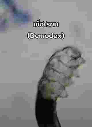 ตรวจเชื้อสิว