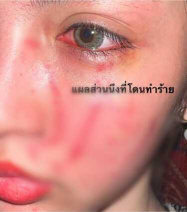 โนอา ภญมณ