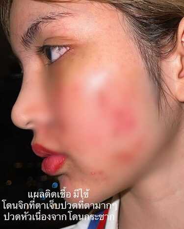 โนอา ภญมณ