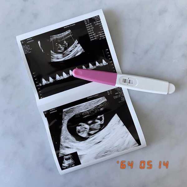 แฟนแต๊งค์ พงศกร ท้อง